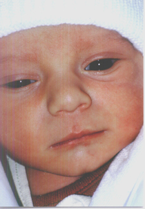 Brogli Blint 2008.jpg